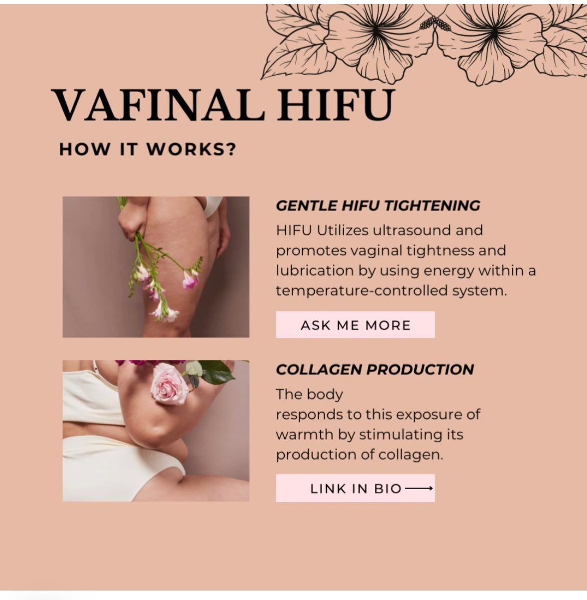 FemiLift Ultra – Vaginal Rejuvenation Hifu