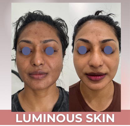 LIFT Brighten &amp; Tighten Package