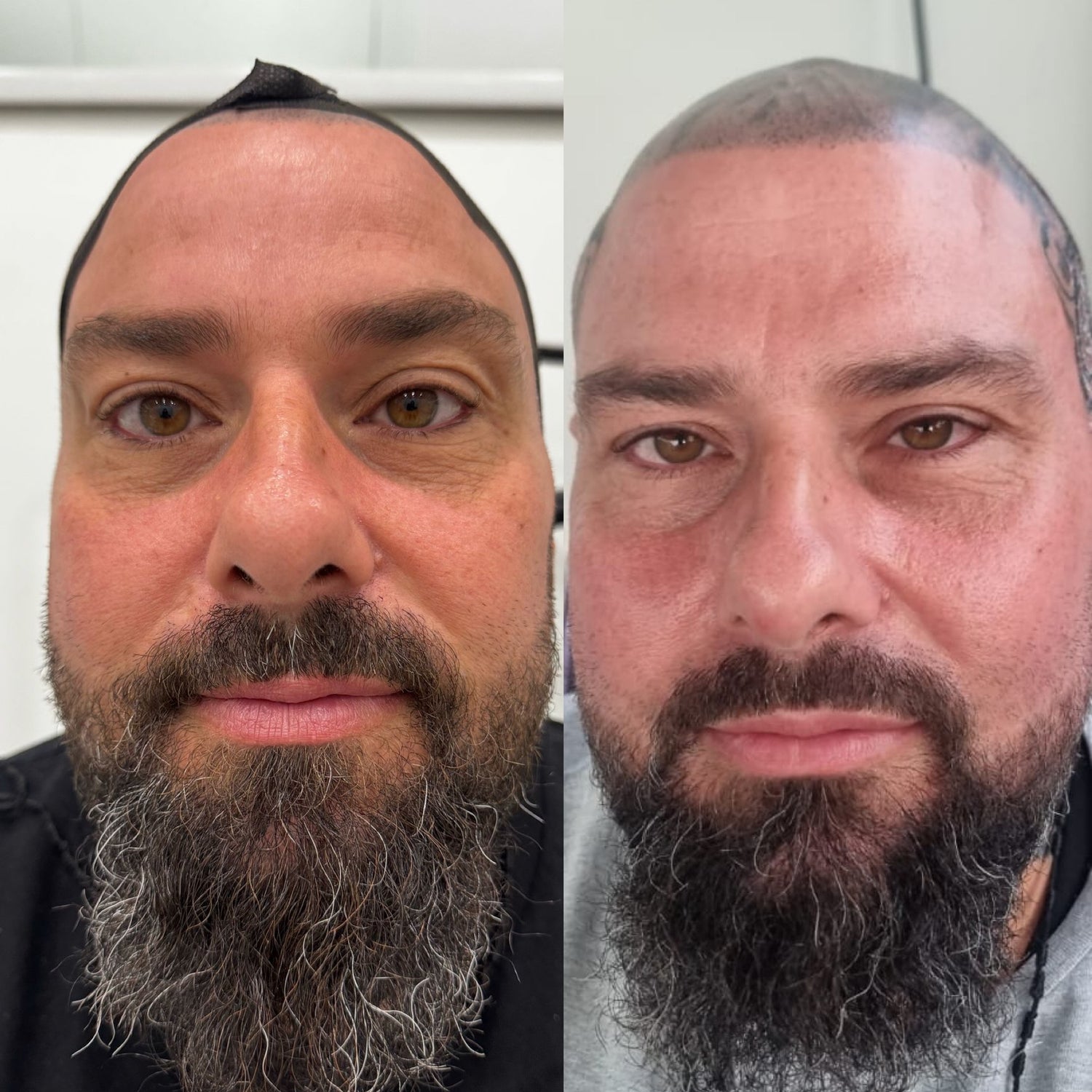 LIFT Brighten &amp; Tighten Package