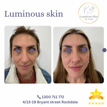 LIFT Brighten &amp; Tighten Package